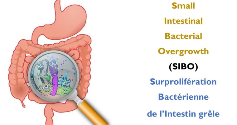 Rémission naturelle du SIBO – naturopathie