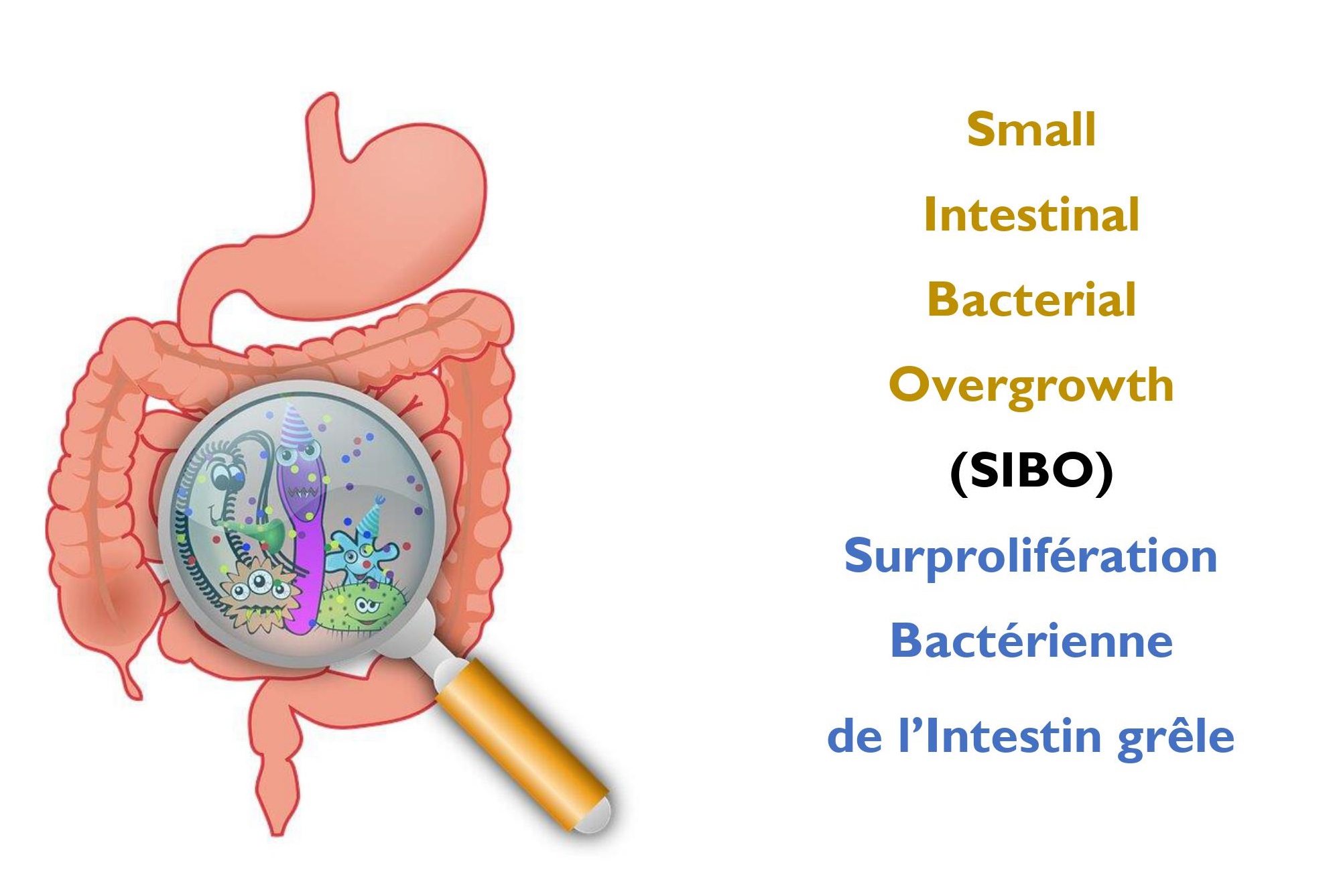 Rémission naturelle du SIBO – naturopathie