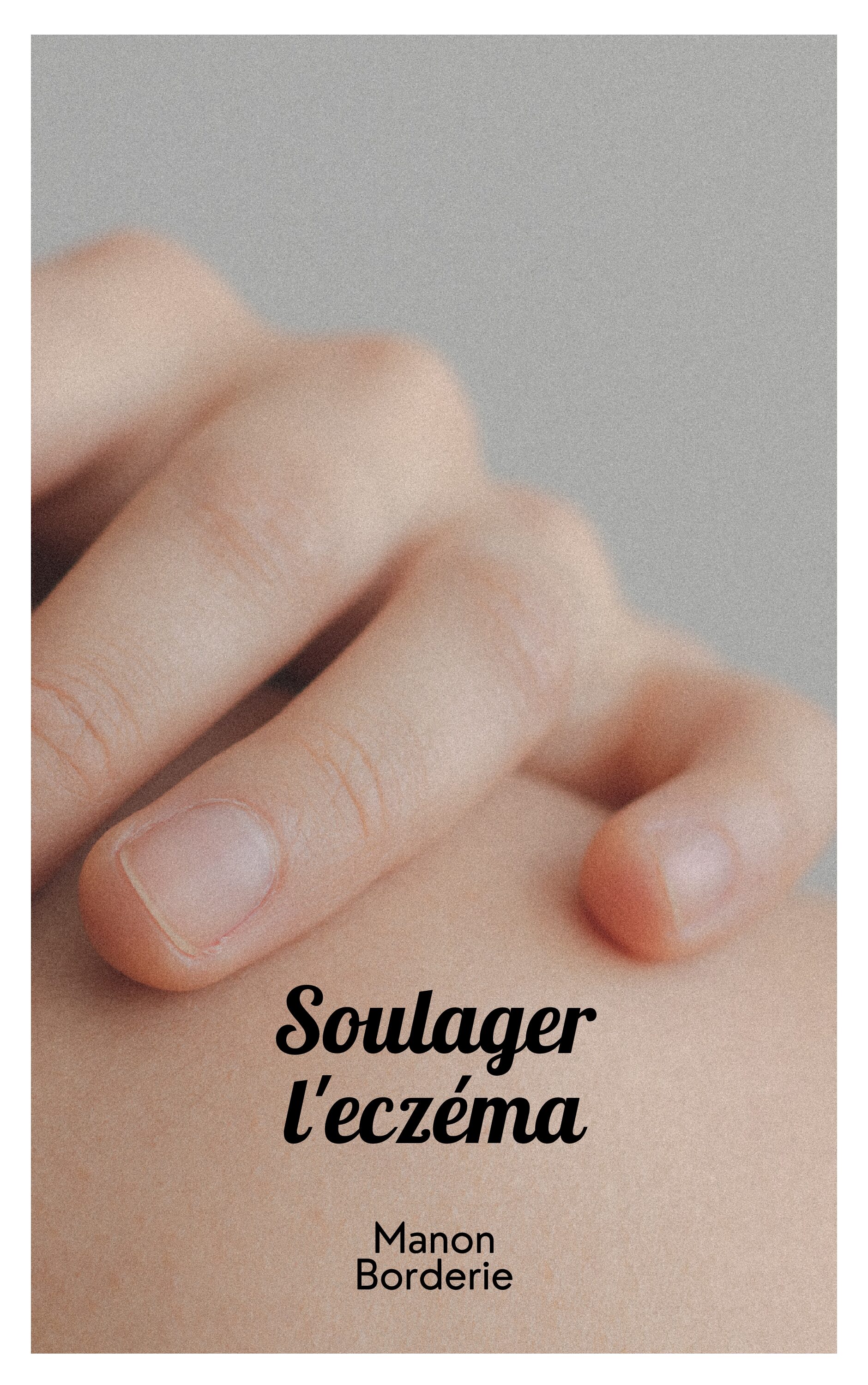 Soulager l'eczéma